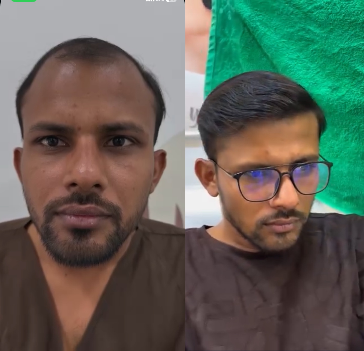 Mole and Wart Removal Before and After